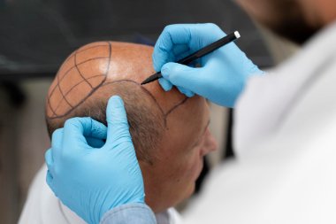 Hair Clinic